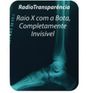 Bota-Imobilizadora-AC0021-Radiografia-Orthopauher